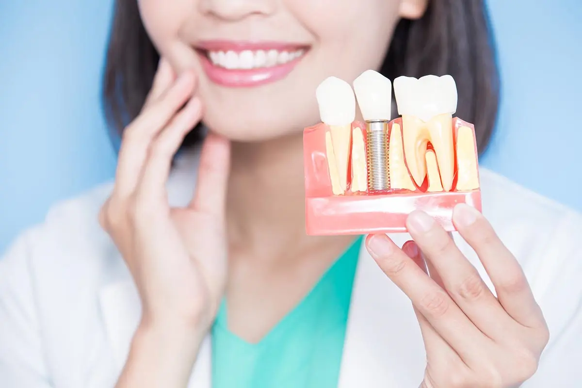 Что нужно знать перед имплантацией зубов